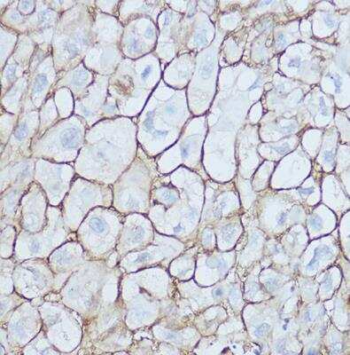 Immunohistochemistry-Paraffin: CD44 Antibody - Azide and BSA Free [NBP2-92947]