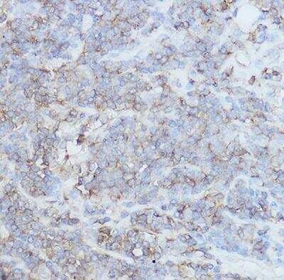 Immunohistochemistry-Paraffin: CD44 Antibody - Azide and BSA Free [NBP2-92947]