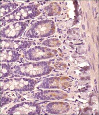 Immunohistochemistry-Paraffin: CD44 Antibody (OX-50) - BSA Free [NB600-1317]