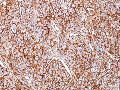 Immunohistochemistry-Paraffin: CD44 Antibody (SPM521) - IHC-Prediluted [NBP2-48407]