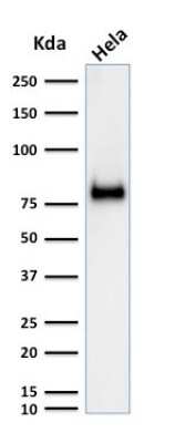 Western Blot: CD44 Antibody (SPM521) [NBP2-45255]