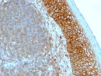 Immunohistochemistry-Paraffin: CD44 Antibody (SPM544) - Azide and BSA Free [NBP2-34420]