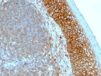 Immunohistochemistry-Paraffin: CD44 Antibody (SPM544) - IHC-Prediluted [NBP2-45347]