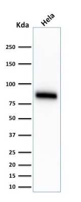 Western Blot: CD44 Antibody (SPM544) [NBP2-34373]