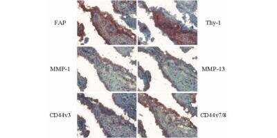 Immunohistochemistry: CD44 Antibody (VFF-17) - variant 7/8 - Azide and BSA Free [NB100-65535]