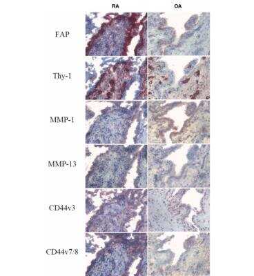 Immunohistochemistry: CD44 Antibody (VFF-17) - variant 7/8 - Azide and BSA Free [NB100-65535]