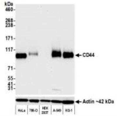 Western Blot: CD44 Antibody (BLR038F) [NBP3-14671]