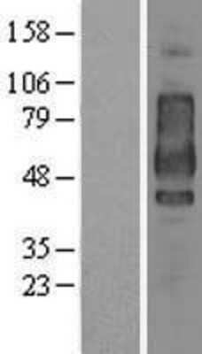 Western Blot: CD44 Overexpression Lysate [NBL1-08952]