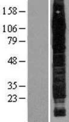 Western Blot: CD44 Overexpression Lysate [NBP2-04167]