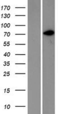 Western Blot: CD44 Overexpression Lysate [NBP2-09078]