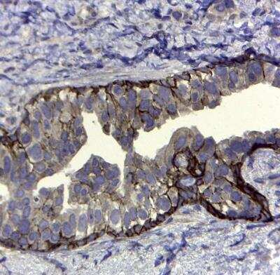 Immunohistochemistry-Paraffin: CD44 Antibody (VFF-8) - variant 5 [NB100-65533]