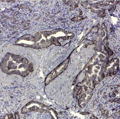 Immunohistochemistry-Paraffin: CD44 Antibody (VFF-8) - variant 5 [NB100-65533]