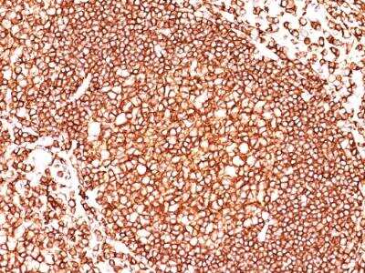 Immunohistochemistry-Paraffin: CD45 Antibody (136-4B5) - IHC-Prediluted [NBP2-48438]