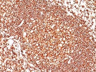 Immunohistochemistry-Paraffin: CD45 Antibody (136-4B5) [NBP2-44840]