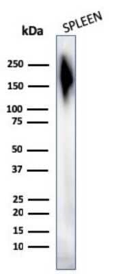 Detection of CD45 in Human Spleen Tissue Lysates in Western Blot