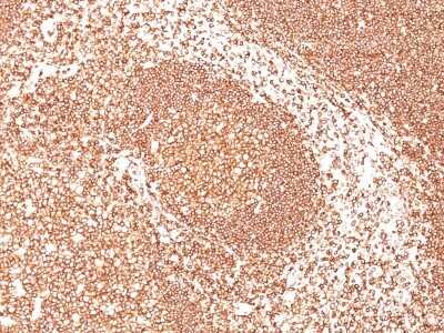 Immunohistological Staining of CD45 in Paraffin Embedded Human Tonsil