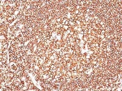 Immunohistochemical Detection of CD45 in Paraffin Embedded Human Tonsil