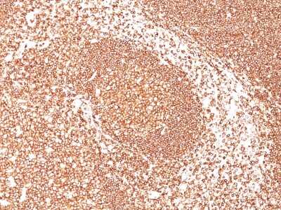 Immunohistological Staining of CD45 in Paraffin Embedded Human Tonsil