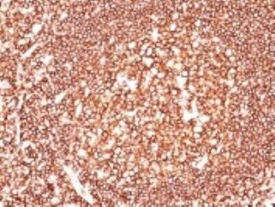 Immunohistochemistry-Paraffin: CD45 Antibody (2B11) - Azide and BSA Free [NBP2-34527]