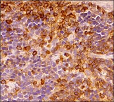 Immunohistochemistry-Paraffin: CD45 Antibody (30-F11) - Azide and BSA Free [NBP2-80652]