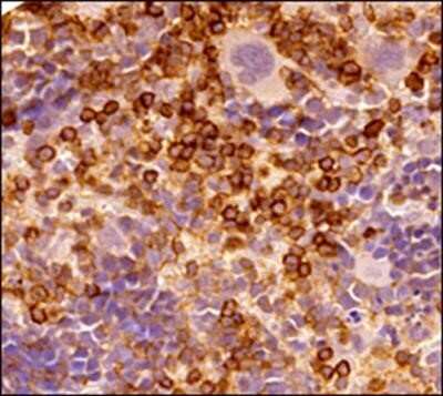 Immunohistochemistry-Paraffin: CD45 Antibody (30-F11) - Azide and BSA Free [NBP2-80652]