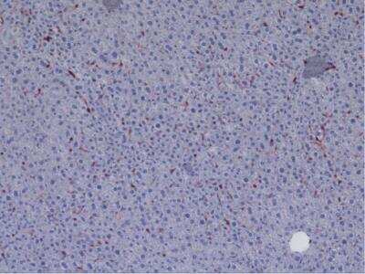 Immunohistochemistry: CD45 Antibody (30-F11) - BSA Free [NB100-77417]