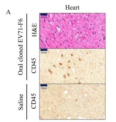 Immunohistochemistry: CD45 Antibody (30-F11) - BSA Free [NB100-77417]