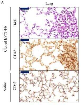 Immunohistochemistry: CD45 Antibody (30-F11) - BSA Free [NB100-77417]