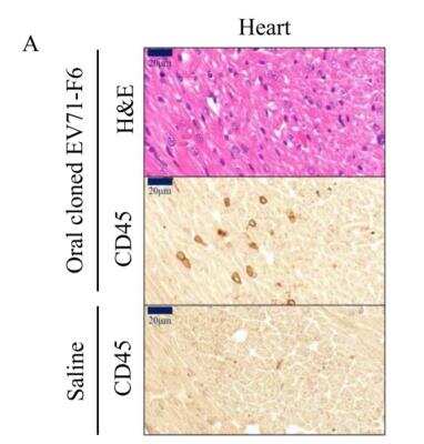 Immunohistochemistry: CD45 Antibody (30-F11) - BSA Free [NB100-77417]