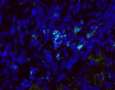 Immunohistochemistry-Paraffin: CD45 Antibody (30-F11) - BSA Free [NB100-77417]