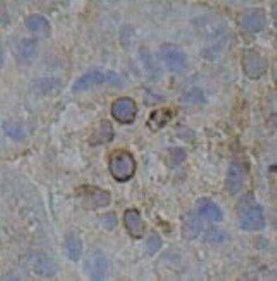Immunohistochemistry-Paraffin: CD45 Antibody (30-F11) - BSA Free [NB100-77417]