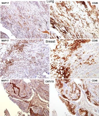 Immunohistochemistry-Paraffin: CD45 Antibody (5C16) - Azide and BSA Free [NB110-93609]