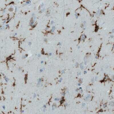 Immunohistochemistry-Paraffin: CD45 Antibody (CL0159) [NBP2-52868]