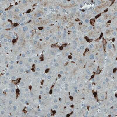 Immunohistochemistry-Paraffin: CD45 Antibody (CL0159) [NBP2-52868]