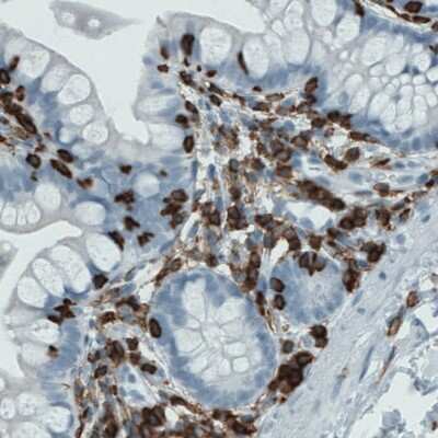 Immunohistochemistry-Paraffin: CD45 Antibody (CL0159) [NBP2-52868]