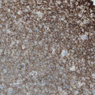Immunohistochemistry-Paraffin: CD45 Antibody (CL0159) [NBP2-52868]