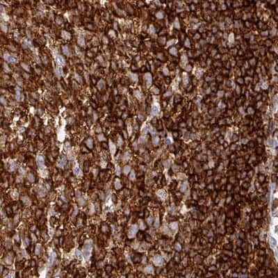 Immunohistochemistry-Paraffin: CD45 Antibody (CL0160) [NBP2-14783]