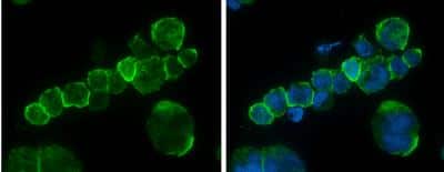Immunocytochemistry/ Immunofluorescence: CD45 Antibody [NBP2-15811]