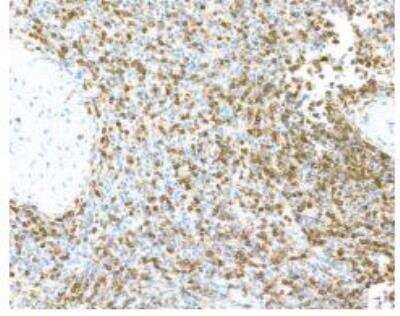Immunohistochemistry-Paraffin: CD45 Antibody (BL-178-12C7) [NBP3-14668]