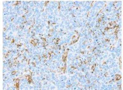 Immunohistochemistry-Paraffin: CD45 Antibody (BL-178-12C7) [NBP3-14668]