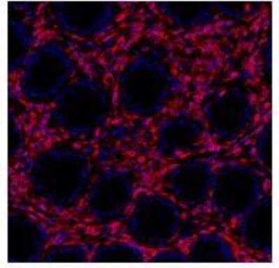 Immunohistochemistry: CD45 Antibody (BL-178-12C7) [NBP3-14668]