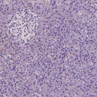 Immunohistochemistry-Paraffin: CD45 Antibody [NBP1-88103]