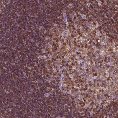 Immunohistochemistry-Paraffin: CD45 Antibody [NBP1-88103]