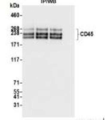 Immunoprecipitation: CD45 Antibody (BL-178-12C7) [NBP3-14668]