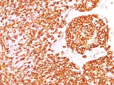 Immunohistochemistry-Paraffin: B220/CD45R Antibody (PTPRC/1460) - Azide and BSA Free [NBP2-54465]