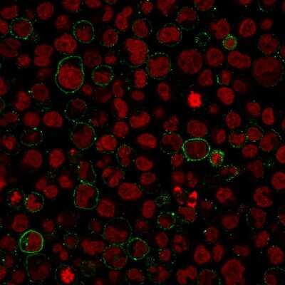 Immunocytochemistry/ Immunofluorescence: CD45 Antibody (PTPRC/1975R) [NBP3-07167]