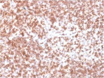 Immunohistochemistry-Paraffin: CD45 Antibody (PTPRC/1975R) [NBP3-07167]