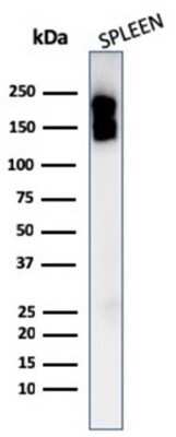 Western Blot: CD45 Antibody (PTPRC/1975R) [NBP3-07167]