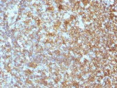 Immunohistochemistry-Paraffin: CD45 Antibody (SPM496) - IHC-Prediluted [NBP2-48439]