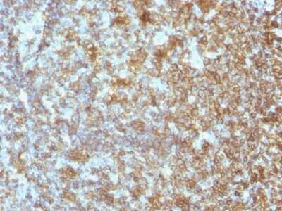 Immunohistochemistry-Paraffin: CD45 Antibody (SPM496) [NBP2-44841]